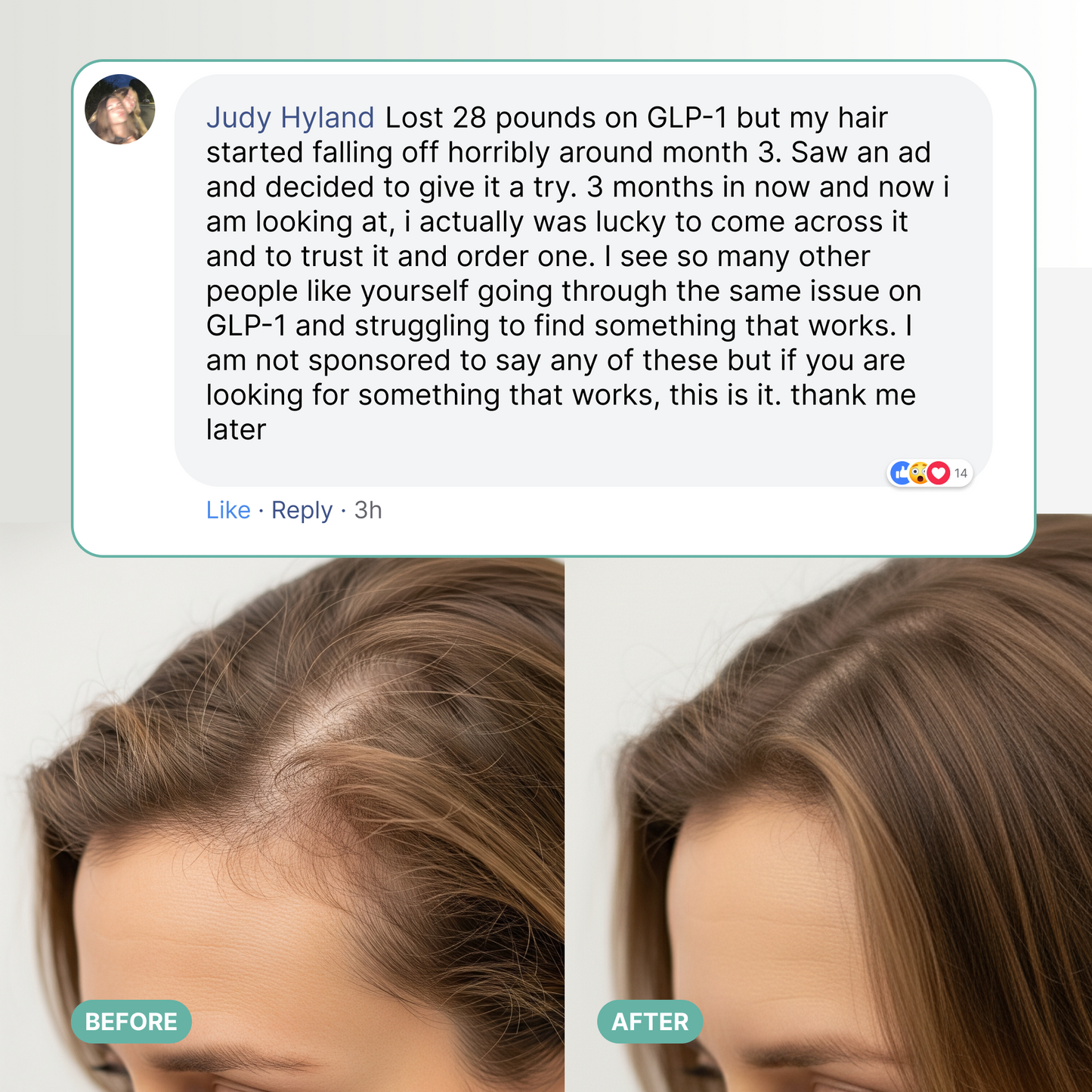 Hair Replenish Gummies